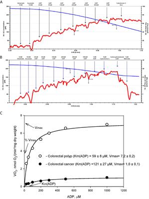 Energy Metabolic Plasticity of Colorectal Cancer Cells as a Determinant of Tumor Growth and Metastasis